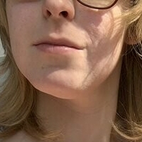 Acvalens Naakt