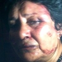 Ana Luisa Pardo Naakt