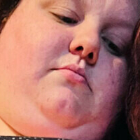 chunkybabee Naakt
