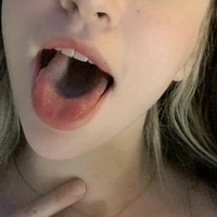 Claraxde Naakt