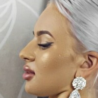 Florina Naakt