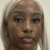 freckledn Naakt
