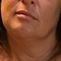 Lady Lara Naakt