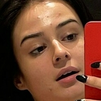 Lauraysergii Naakt