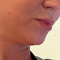 misslobatox Naakt