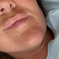 naughty_katarina_free Naakt