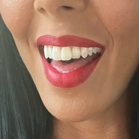rachelstarrxxx Naakt