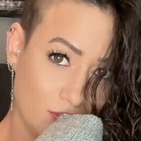 rocking_alopecia Naakt