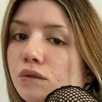 sumchloefree Naakt
