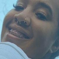xteeacakessfreex Naakt